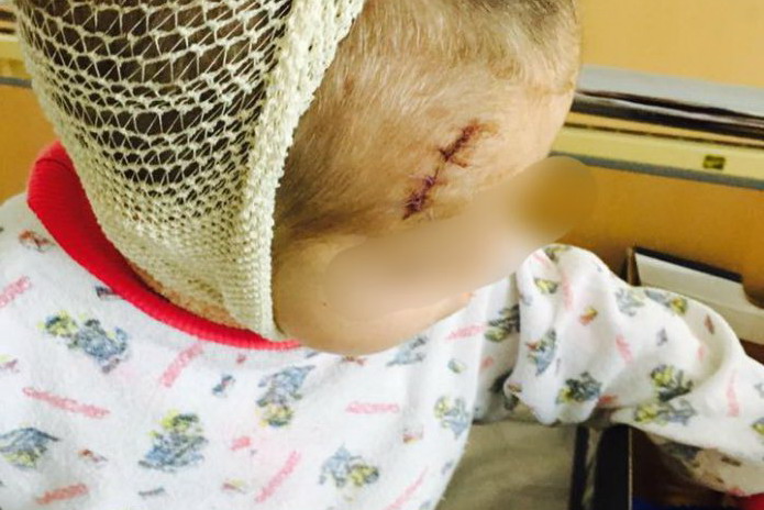 REVOLTĂTOR! Copil de nici doi ani, ajuns la spital după ce a fost bătut de părinţi