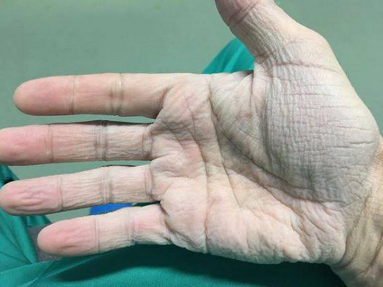 Un apel la rațiune! Cum arată mâna unui chirurg care oprerează inimi!