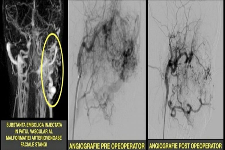 A salvat sute de vieți, dar acum cere ea însăși ajutorul celor cu suflet! Mesajul emoționant al unei asistente de la Lugoj