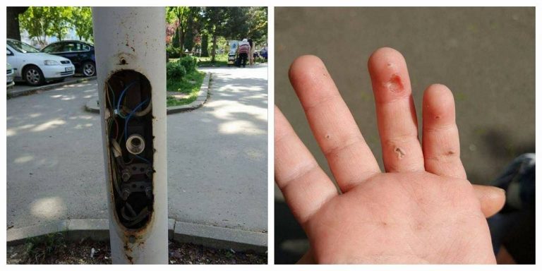 Copil cu mâna arsă după ce a atins firele unui stâlp dintr-un parc, la Timişoara