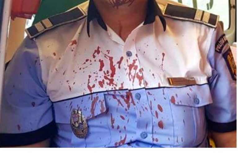 Polițist din Banat, atacat cu toporul după ce a fost chemat să aplaneze un conflict într-o familie de romi