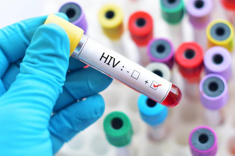 Timișean depistat cu HIV. Poliția anchetează cazul
