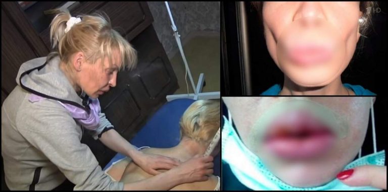 Condamnată la închisoare după ce a injectat 500 de femei cu un gel dintr-o găleată