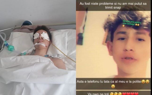 Băiat de 14 ani, în moarte cerebrală, după ce a fost bătut cu bestialitate. Agresorul postează mesaje pe Facebook