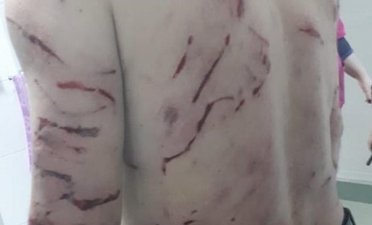 Hunedoreanul mușcat de haita de câini are nevoie de tratament cu ser antirabic. A fost transportat la Timișoara