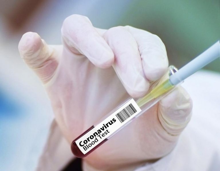 24 de cadre medicale de la Spitalul Județean Arad, confirmate pozitiv cu noul coronavirus