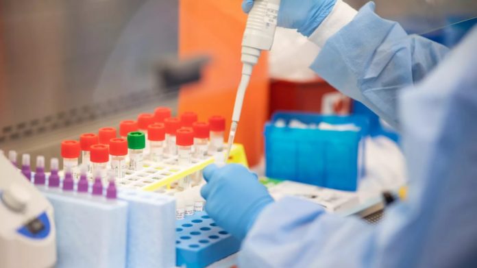 test-coronavirus-1170x658