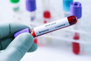 Nou bilanț: 1053 de pacienți cu coronavirus au murit