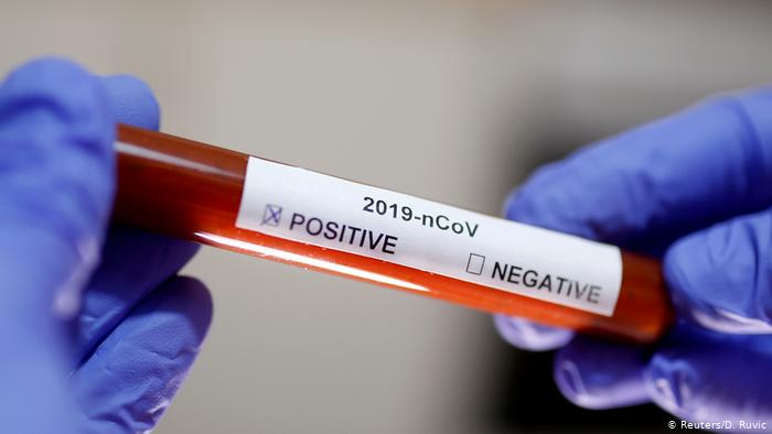 Coronavirus în România: Cel mai mic număr de noi cazuri raportate din ultimele două luni