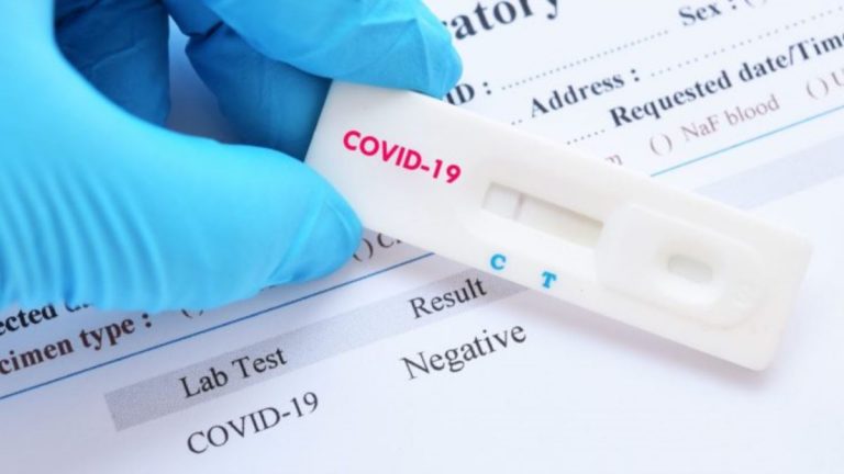 Testele pentru depistarea COVID-19 de la două spitale din vestul țării, decontate de stat
