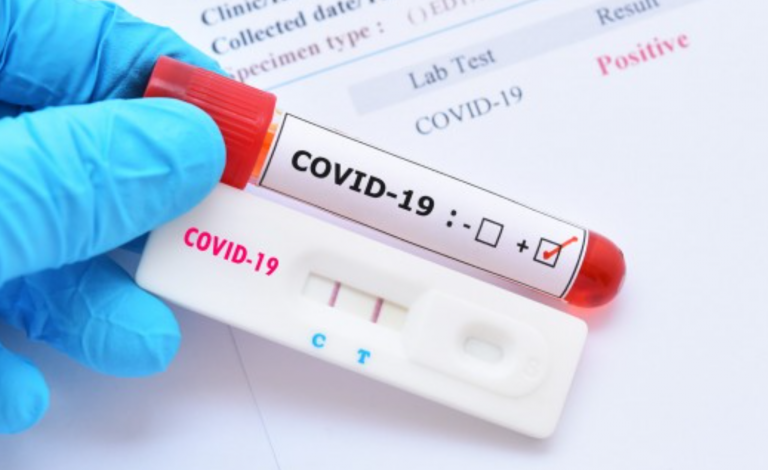 Peste 30 de cazuri noi de coronavirus, în Timiș